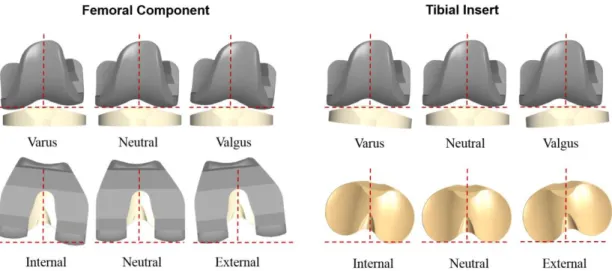 Fig. 7 Schematic of the varying configurations for the misalignment of components in left TKA