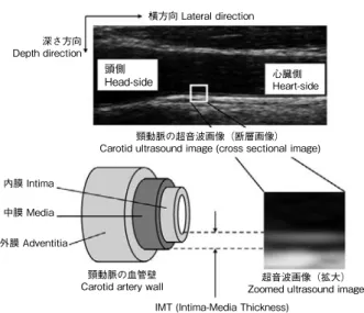 Fig. 1   Relation between carotid ultrasound image and IMT横方向 Lateral direction頭側Head-side内膜 Intima深さ方向Depth direction中膜 Media心臓側Heart-side頸動脈の超音波画像（断層画像）
