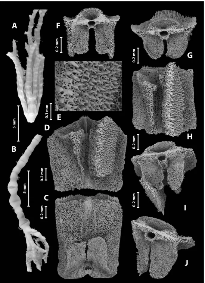 Fig. 2.  Hirsutocrinus duplex n. gen. and sp., holotype. A, Radial ring with arms; B, dististele and radix with fouling; C, IBr1, view from in- in-side; D, IBr2 with knobby process, view from inin-side; E, detail of knobby process articular surface; F, dis