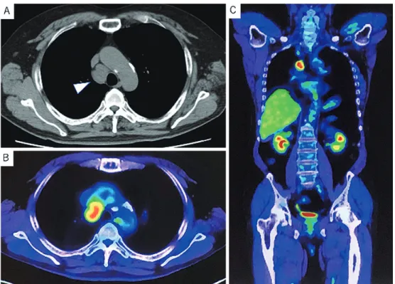 Figure   1   Preoperative imaging findings.