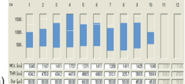 Fig. 3. Audiograms.  a) Audiogram acquired at 3 months after the surgery. A response of 40 dB is found at 1 and 2 kHz, which are the  frequency bands commonly used in conversations
