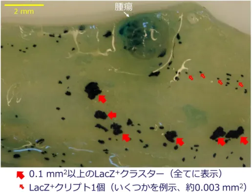 図 III-4 に AOM および DSS を投与したマウスについて、解剖後に LacZ 染色を行った大