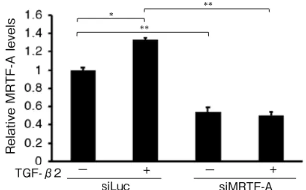 Fig. 1. Effect of MRTF-A siRNA (siMRTF-A) and  TGF-β2 on the MRTF-A mRNA expression  in ARPE-19 cells (p < 0.0001, ANOVA)