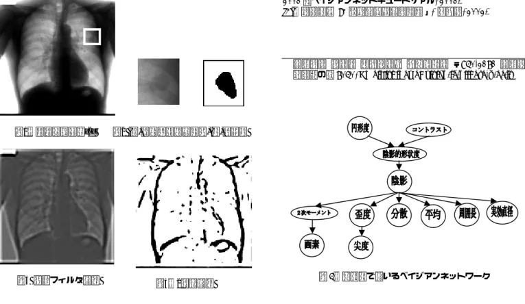 図 5 本研究で用いるベイジアンネットワーク 