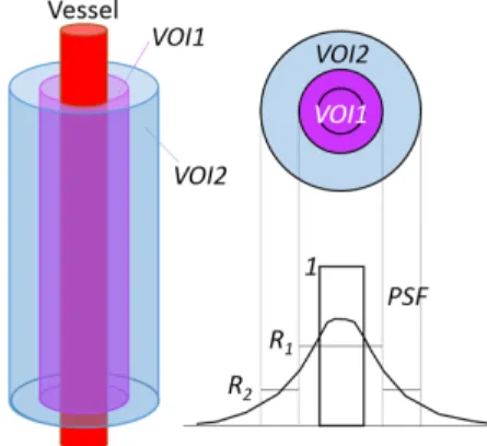 Fig. 1  Model for estimating input function from the carotid  arterial regions on PET images, as originally proposed by  Iguchi et al  18）.