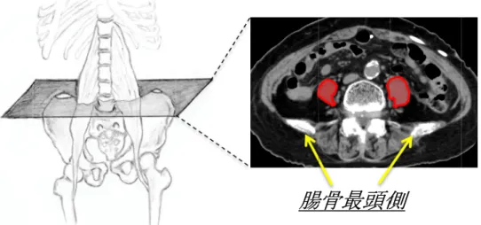図 3  大腰筋面積の測定方法 大腰筋面積の測定方法 大腰筋面積の測定方法 