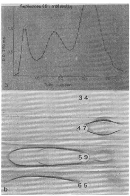 Fig.  2a.  Fractionation  of  rat  serum ƒÁ-globulins  by  sepharose-6B  column  chromatography.