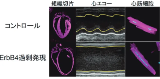 図 2 ErbB4 を過剰発現した心臓は，壁の菲薄化，および心