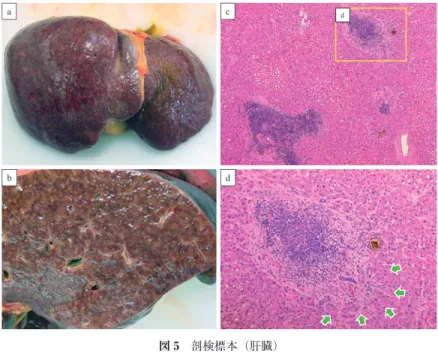 図 5 剖検標本（肝臓） 標本の表面（a）や割面（b）の肝実質は軽度顆粒状である．c）ヘマトキシリン・ エオジン（HE）染色，原倍率×40．門脈域に異型リンパ球の浸潤を認める．d） ヘマトキシリン・エオジン（HE）染色，原倍率×400，類洞内に異型リンパ球 を認める（緑矢印）．a c dbd 図 6 剖検標本（肺） 右肺，HE 染色，a）原倍率×40，びまん性肺胞出血を認める．b）原倍率× 400，肺にも異型リンパ球を認める． 左肺，HE 染色，c）原倍率×40，びまん性肺胞出血を認める．d）原倍率× 40