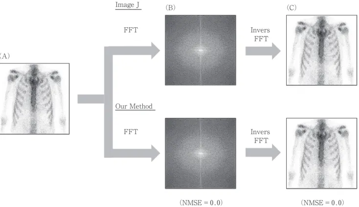 Fig .   3   Examination result of the two - dimensional Fourier transform .( A ) Original image of chest bone scintigram of anterior view .( B ) Power  spectrum provided by Image J and our method .( C ) Image after the filter processing 