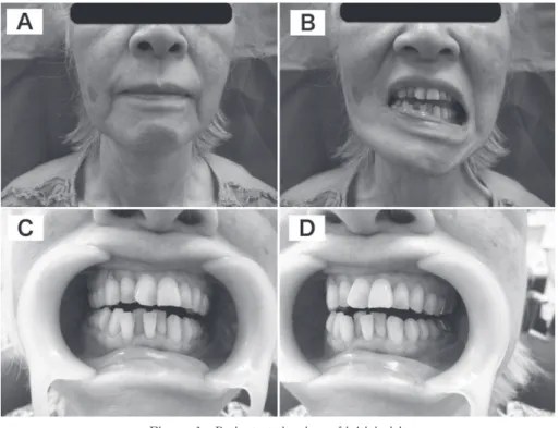 Figure 1　Patient at the time of initial visit A，B：Facial view.