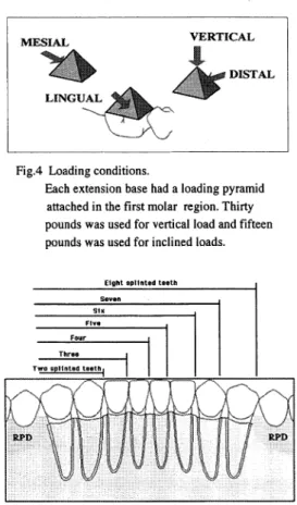 Fig.  2  Alveolar  bone  configurations.