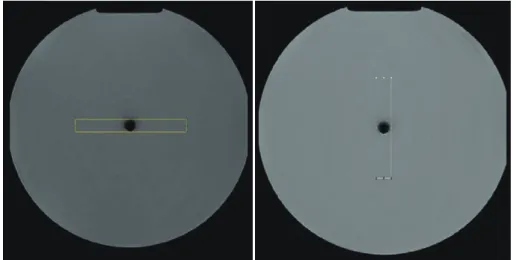 Figure 4　 Region of interest  （ ROI ）  used to measure the size of artifacts The ROIs were placed for the measurement of metal artifacts in the phase- and  frequency-encoding directions.