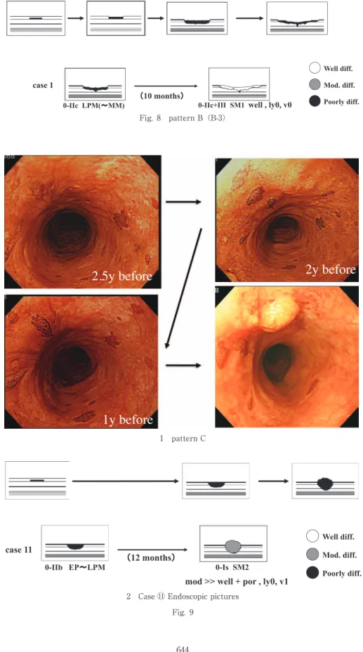 Fig. 8　pattern B（B-3）