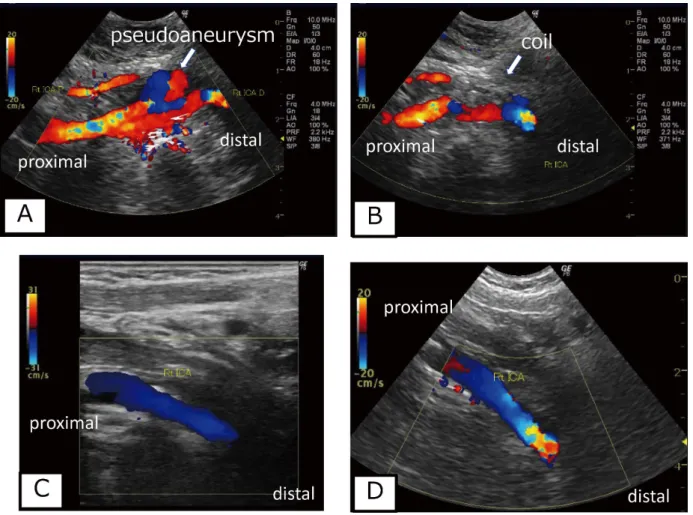 Fig. 2  Transoral carotid ultrasonography (TOCU)