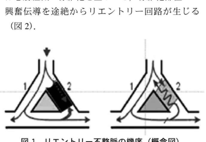 図 1 リエントリー不整脈の機序（概念図） 左：心筋の一部，2 の部分に伝導障害が生じている． 右：2 の部分の伝導が途絶し，一方向性のブロックとな り，リエントリー不整脈が発生する． 図 2 心筋梗塞周囲に生じたリエントリー不整脈（概念図） 心筋梗塞と正常心筋の境界部では壊死組織と心筋組織 が混在している．このような領域で矢印のように電気的 興奮が旋回し，リエントリーを起こすことがある．