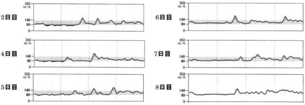 Fig. 1 　24 時間持続血糖測定（Abbott 社 Free Style リブレ Pro）