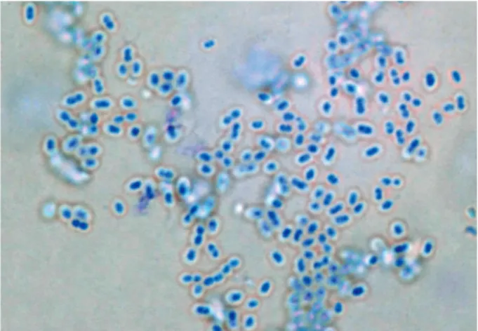 Fig. 1. Capsular swelling reaction of S. pneumoniae type 6B. 