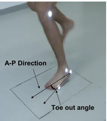 Figure 1 Toe out angle