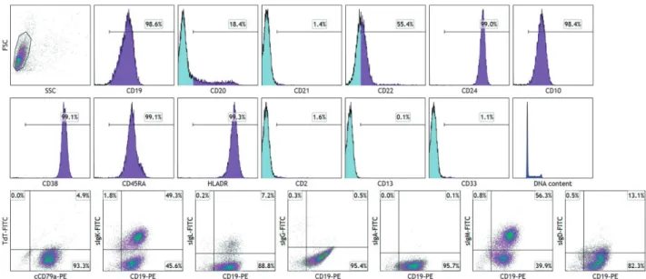 Figure 3. FCM of leukemia cells in case 10. Top and middle. Single parameter FCM. Positive cell populations for each antigen  are indicated by horizontal bars and colored in purple
