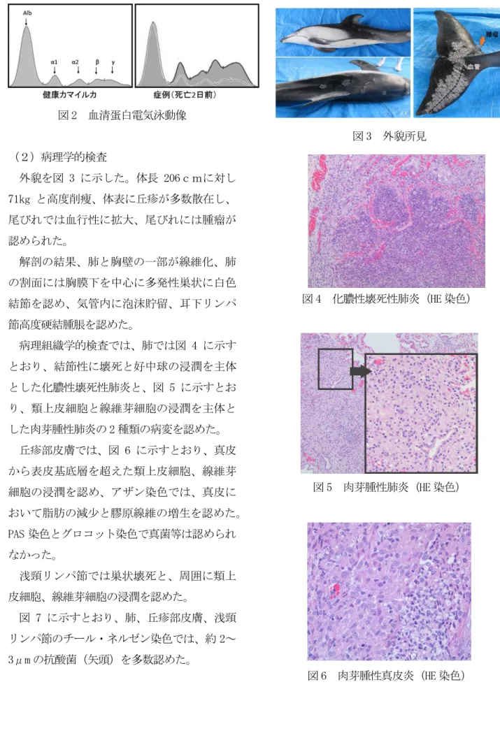 図 2  血清蛋白電気泳動像  （２）病理学的検査  外貌を図 3 に示した。体長 206ｃｍに対し 71kg と高度削痩、体表に丘疹が多数散在し、 尾びれでは血行性に拡大、尾びれには腫瘤が 認められた。  解剖の結果、肺と胸壁の一部が線維化、肺 の割面には胸膜下を中心に多発性巣状に白色 結節を認め、気管内に泡沫貯留、耳下リンパ 節高度硬結腫脹を認めた。  病理組織学的検査では、肺では図 4 に示す とおり、結節性に壊死と好中球の浸潤を主体 とした化膿性壊死性肺炎と、図 5 に示すとお り、類上皮細胞と線維