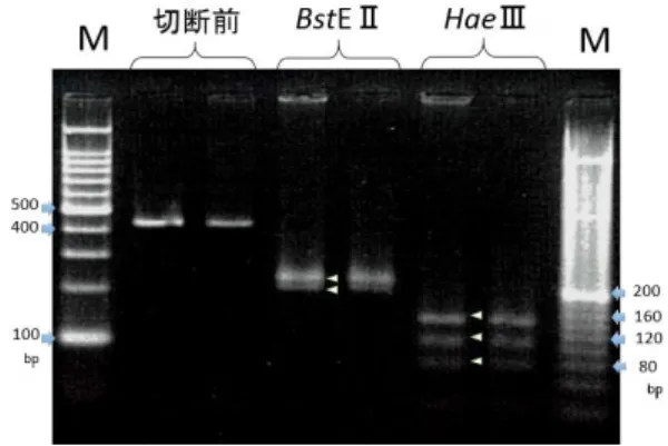 図 7  丘疹部皮膚(チール・ネルゼン染色)  （３）細菌学的検査  スタンプ標本の直接鏡検では、肺と丘疹部 皮膚で多数のグラム陰性菌を、チール・ネル ゼン染色では、肺、丘疹部皮膚、リンパ節で 抗酸性小桿菌を確認した。  分離培養では、肺、丘疹部皮膚から Vibrio  alginolyticus、Proteus  penneri、Schewa-nella putrefaciens を分離した。肺、丘疹部 皮膚、リンパ節の 25℃培養、2～3 週間で Mycobacterium 属菌を分離した。  分離され
