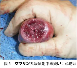 図 2  敗血症：陰嚢膿瘍  図 3  PRRS：初期の肺炎、肉眼では判別困  難  図 4  PCVAD：肺の一様な退縮不全  図 5  クマリン系殺鼠剤中毒疑い：心筋及 び心外膜の著しい出血 4 考察及び今後の展望 A 農場では、離乳直後の死亡豚は雄に偏る傾向があり、1 頭に陰嚢膿瘍が観察された。これは、去勢後に細菌感染を起こし死亡した可能性が考えられた。聞き取りからも、去勢 後の処置が適切でないことが推察され、今後、より衛生的な処置を行うことで離乳豚の死亡が減少する可能性があると考えられた。今までの当