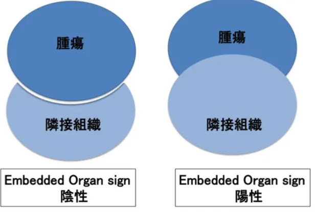 図 7 Embedded organ sign の模式図