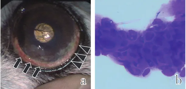 Fig. ₃  外科摘出後に認められた腫瘍性病変（a）とその細胞診像（b）。 左眼の ₄ 時（矢頭）および ₆-₇ 時（矢印）に