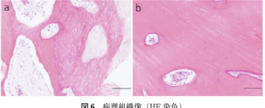 図 6 病理組織像（HE 染色） a：Bar=1,000 μm；筋突起表層に線維組織の付着を認め，線維組織に隣接 して軟骨組織，骨組織の形成を認める。b：Bar=1,000 μm；内部に層板構造 と豊富な骨細胞を認める。 図 7 ヤセック開口訓練器を用いた開口訓練 歯科医師の介助下に開口訓練を実施している様子。前方滑 走の誘導量は 5 mm で，開口制限ピース（矢印）により，最 大開口量は 30 mm に調整している。  図 8 術後 1 年 7 か月経過時，パノラマエックス線写真左側筋突起部に骨のリモデリ