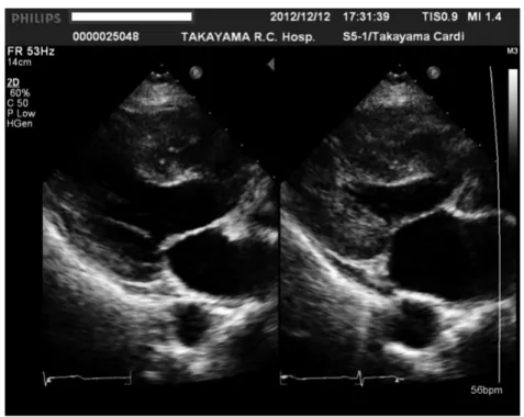 Fig. 2.   Echocardiograms after return of spontaneous circulation.