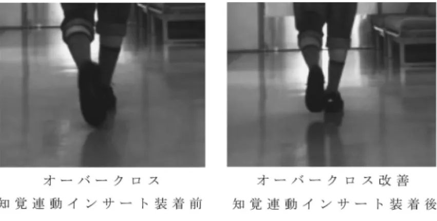図 6 知覚連動インサート装着前後
