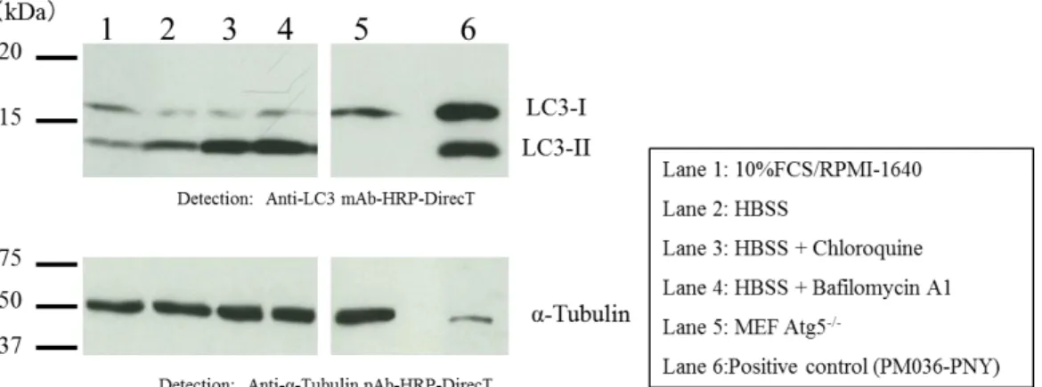 Fig.  3  shows  the  results  of  autophagy  flux  assay  by  western  blot  using  the  above  protocol