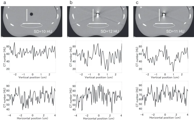 Fig. 7 Comparison of CT number profiles and CT number standard deviations (SDs).
