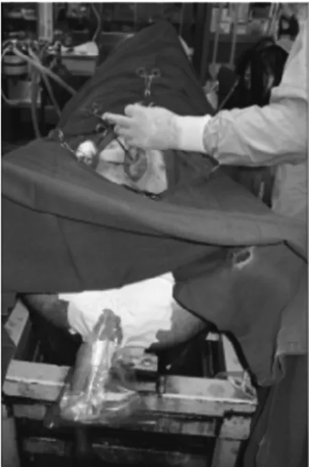 Fig. 2. Laparotomy after device insertion.