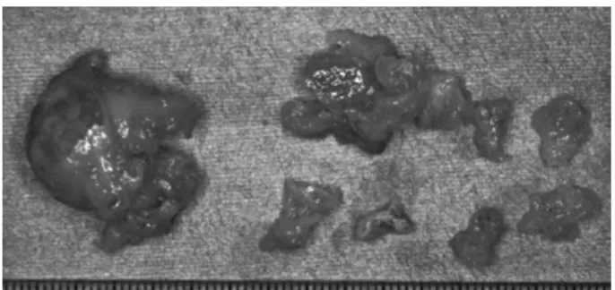 Fig. 6　Histopathological ﬁndings
