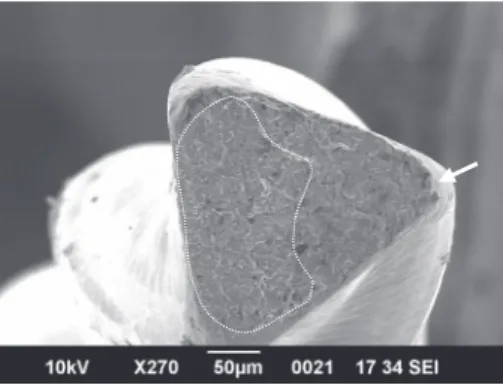 Fig.　₄　 Scanning electron microscopic  images of fractured files of  NX group