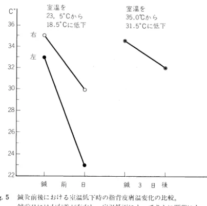 Fig.  5  に,  サ ー モ グラ ム よ り読 み取 つた 冷 却 時 の 指 背 皮膚 温 の変 化 を示 した 。鍼 刺 激前 日の室 温 低 下 前 は,  右 指 背 が35℃,  左 が33℃で あ り, 左 右 差 が2.0℃で あ つた が,  室 温 を5℃低 下 した と ころ,  右 は 室 温 低 下 幅 と同 じ く5℃低 下 して30℃ とな つた が,  左 は 倍 の10℃低 下 して23℃と な り左 右 差 は7℃に 拡 大 した 。 こ の こ とは,  冷 刺