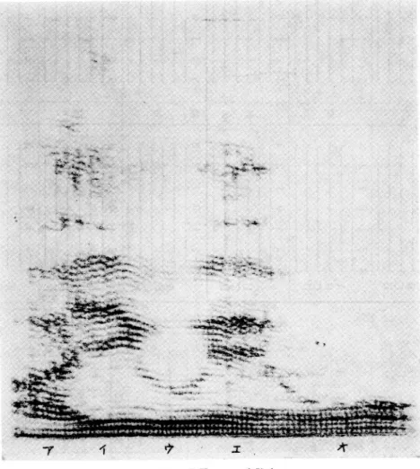 Fig.  16  腎 の 声  T. K  248歳 難 聴