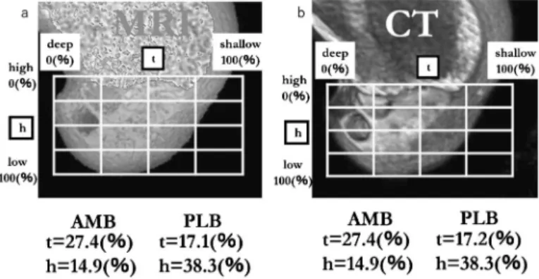 Fig. 2. Quantitative evaluation of MRI (a) and CT (b) images by quadrant method.用した．c