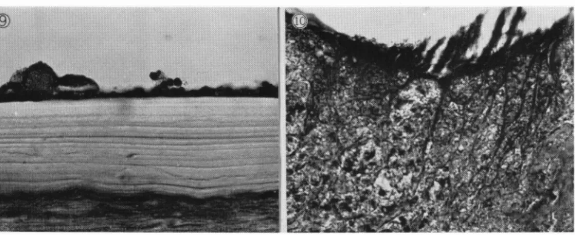 Fig.  9.  Laminated  cuticular  membrane  of  hydatid  cyst  HE, •~356.4.