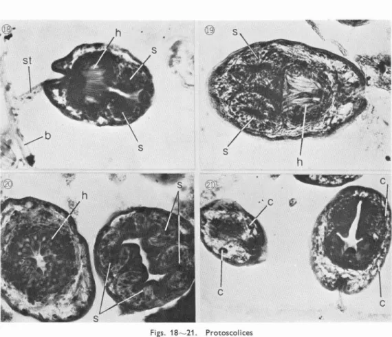 Fig.  17.  Part  of  granulation  tissue  layer  in  which  lymph  follicle  hyperplasia  occurs  HE, •~115.8.