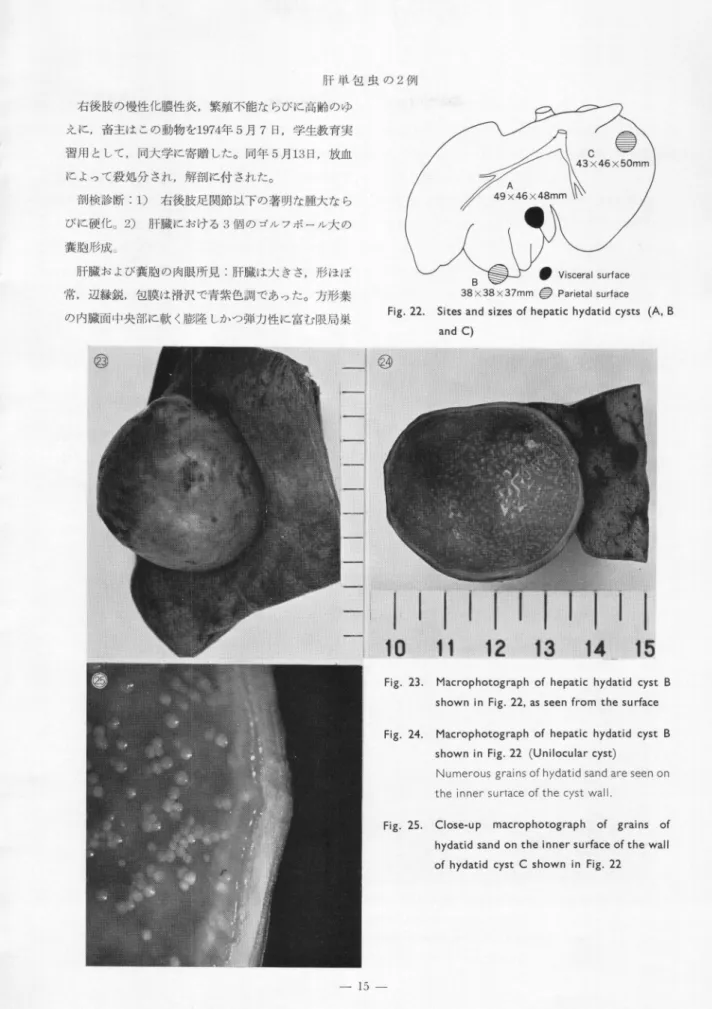 Fig.  23.  Macrophotograph  of  hepatic  hydatid  cyst  B  shown  in  Fig. 22,  as seen  from  the  surface Fig