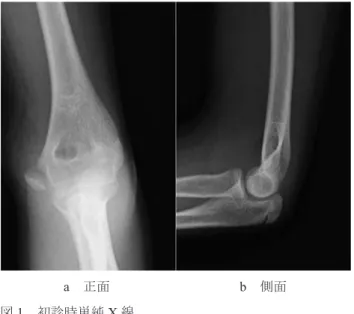図 1 ．初診時単純 X 線