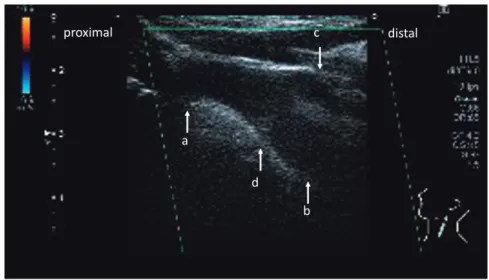 Fig. 4  3D-CT  angiography （撮影条件：管電圧 120 kV，管電流 350 mA，スキャン速度