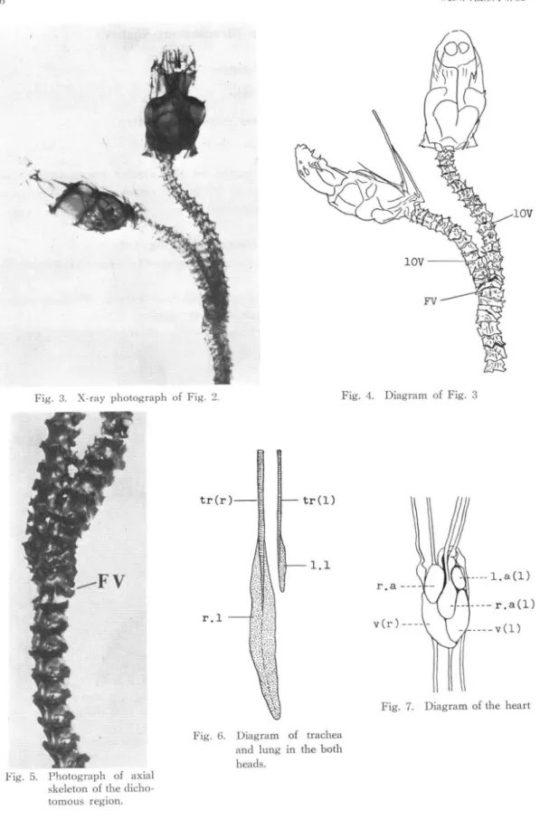 Fig.  3.  X-ray  photograph  of  Fig.  2. Fig.  4.  Diagram  of  Fig.  3