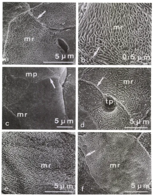 Fig.  4  Variation  of  the  microridge.  (a)  Higher  magnification  of  the  basofrontal  surface  of  a  filiform  papilla  on  the  anterior  dorsal  surface  of  the  tongue