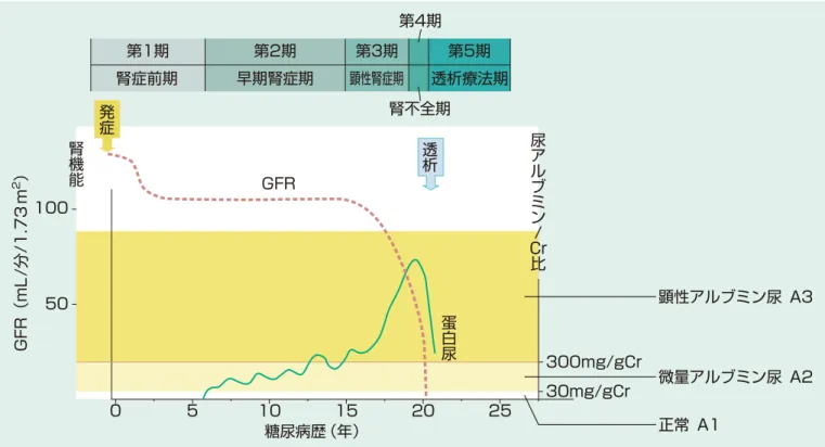 表　14　高齢者に多い腎疾患 一次性 二次性 泌尿器科疾患 糸球体疾患 膜性腎症 微小変化型ネフローゼ症候群 巣状分節性糸球体硬化症 IgA 腎症 糖尿病性腎症 顕微鏡的多発血管炎 （ANCA 関連血管炎）腎アミロイドーシス 肝炎ウイルス関連腎炎 血管性疾患 高血圧性腎症（腎硬化症） 腎動脈狭窄症（動脈硬化症） コレステロール塞栓症 虚血性腎症 尿細管間質疾患 ・ 他 慢性間質性腎炎 骨髄腫腎痛風腎 薬剤性腎障害 前立腺肥大症 （腎後性腎不全）尿路結石腎尿路悪性腫瘍図　19　2 型糖尿病性腎症の臨床経過 （
