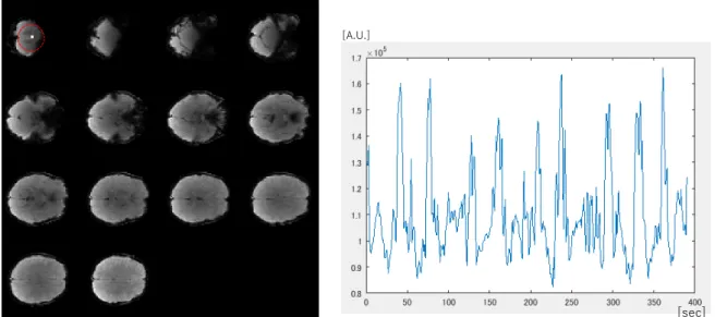 Figure 2. % signal changes of the time courses of TE1, TE 2  and TE 3  at the CSF voxel.