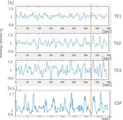 Figure 4.  Time courses of % signal changes from a voxel that has the correlation value of 0.56 with the CSF signal